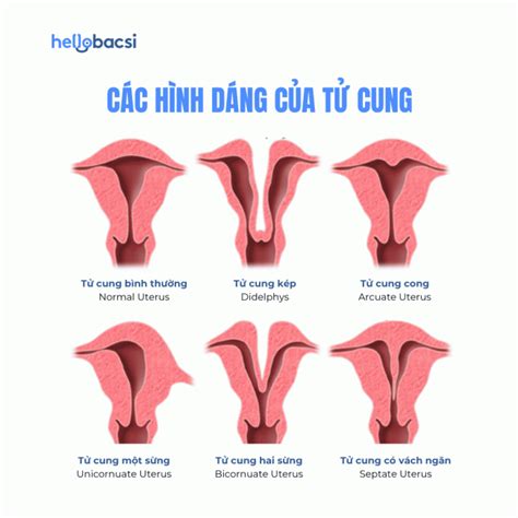 tu cung la gi cau tao vi tri chuc nang va kich  tu cung  bacsi