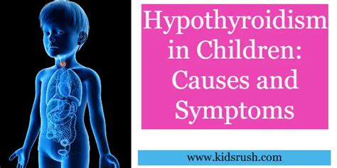 Hypothyroidism in Children: Causes and Symptoms - Kidsrush.com