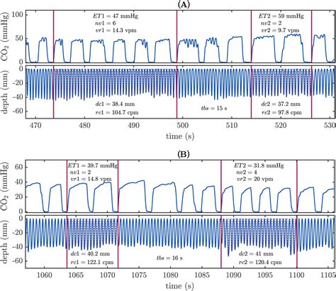 low end tidal co2 during cpr - Ensure The Effective History Image Library