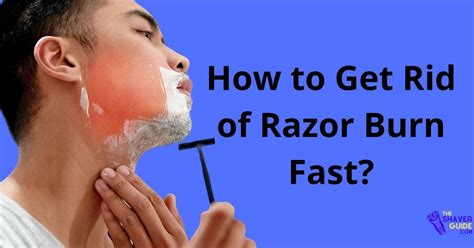 How Long Does Razor Burn Last Causes And Treatment The Shaver Guide