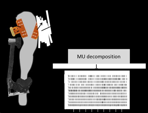 High Density Surface EMG HDEMG Signals 64 Channels Were Recorded