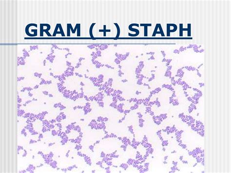 Ppt Bacterial Pathogens Powerpoint Presentation Free Download Id410560