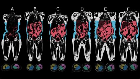 CZI Supports UK Biobank to Create World’s Largest Imaging Dataset To ...