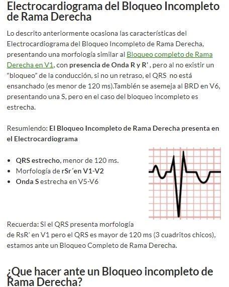 Caracteristicas Del Bloqueo De Rama Sujeto