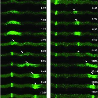 Septum development in hyphae of Neurospora crassa visualized by ...