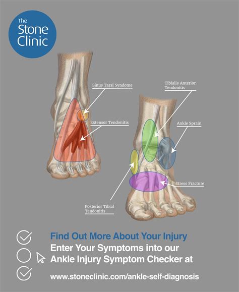 Hurt Your Ankle Use Our Ankle Pain Symptom Checker Tool