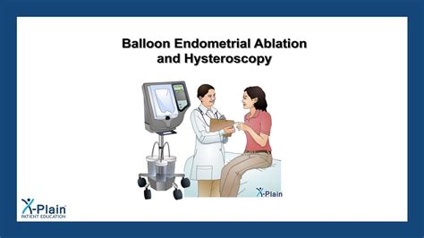 Balloon Endometrial Ablation And Hysteroscopy YouTube