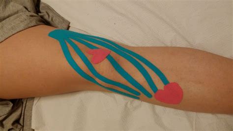 Pin Auf Fisio Rodilla Piernas Tobillos