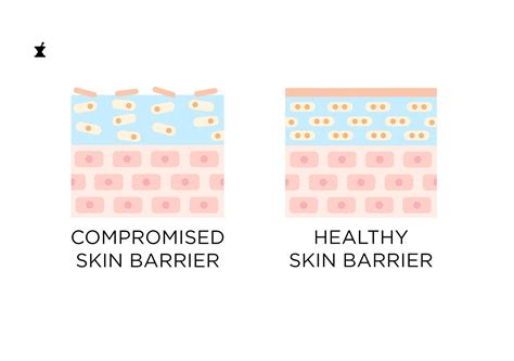 How To Know If Your Skin Barrier Is Damaged Plus Ways To Repair It