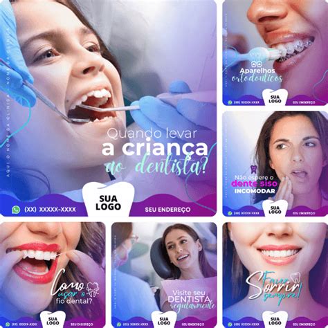 Posts Para Dentistas Pack Canva Artes