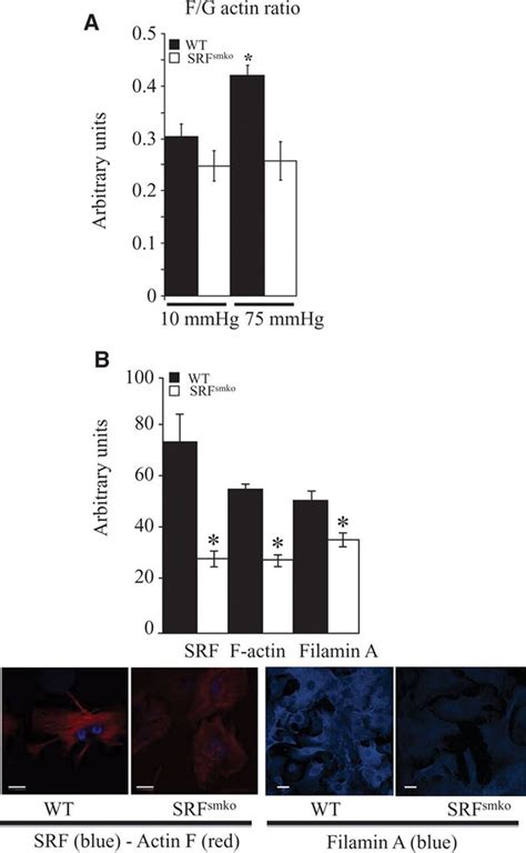 Selective Involvement Of Serum Response Factor In Pressure Induced