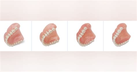 Aspen Dental practices introduce Denture Money-Back Guarantee ...