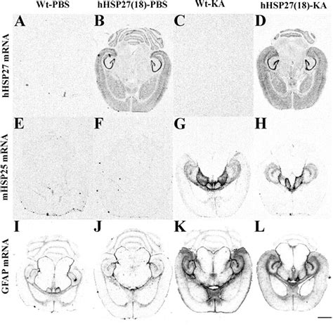 The Neuroprotective Effects Of Heat Shock Protein Overexpression In