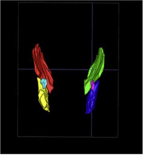 view   muscles  condyle   left condyles  shown