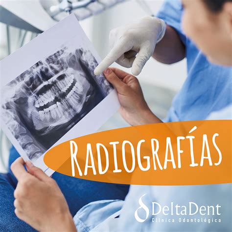 Todo Lo Que Necesitas Saber Sobre Las Radiograf As Dentales Cl Nica