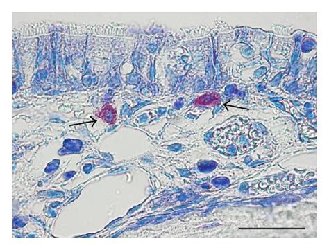 Micrographs Showing Toluidine Blue Stained Sections Of Nasal Septum