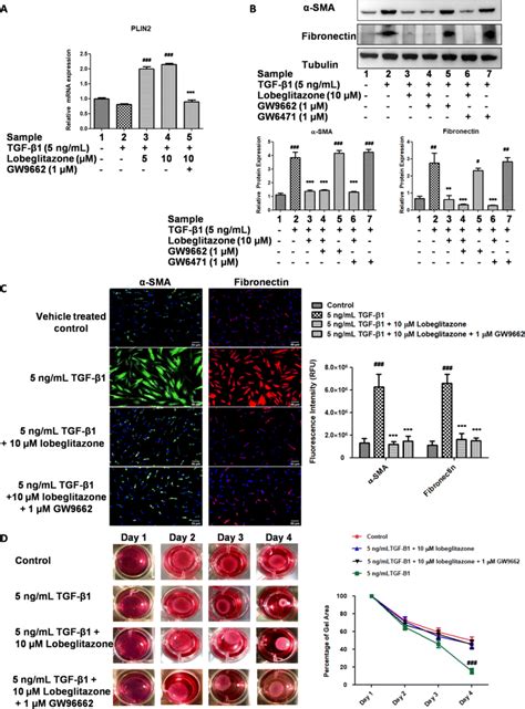 Role Of Ppar Signaling In The Antifibrotic Action Of Lobeglitazone A