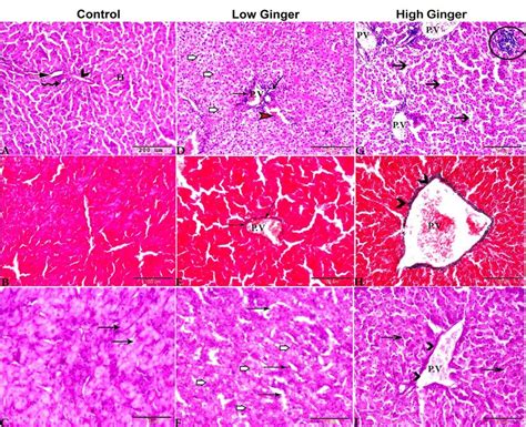 Photomicrograph Of Liver Sections From The Experimental Groups Showing