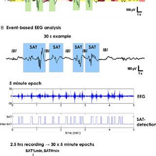 Schematic Presentation Of The Eeg Analysis Paradigms A The