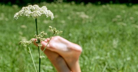 Wild Parsnip Burn Treatment Captions Save