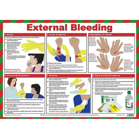 First Aid For External Bleeding Poster First Aid And Treatment Posters