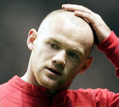 Fashion's World: Wayne Rooney Hair Transplant