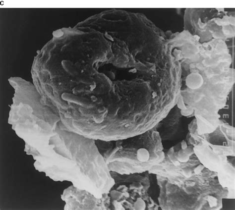 Electron micrographs of a) native high amylose starch, 13000; b) high ...