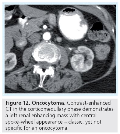 Advanced Cross Sectional Imaging Techniques For The Detection And