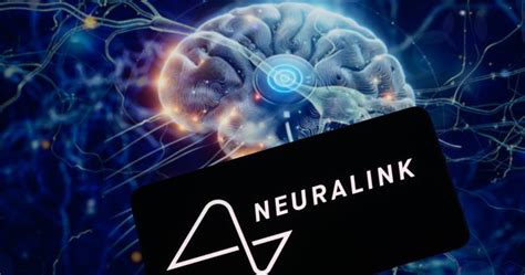 Elon Musk’s Neuralink now accepting Canadian patients - National ...