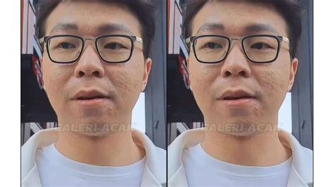 Foto Viral Wajah Asli Dokter Richard Lee Jadi Sorotan Bikin Warganet Kaget