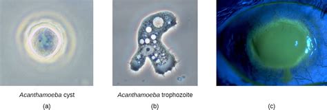 Protozoan And Helminthic Infections Of The Skin And Eyes · Microbiology