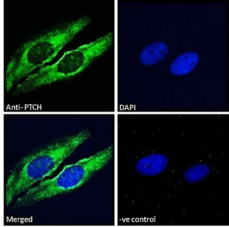Patched Ptch Ab Abcam