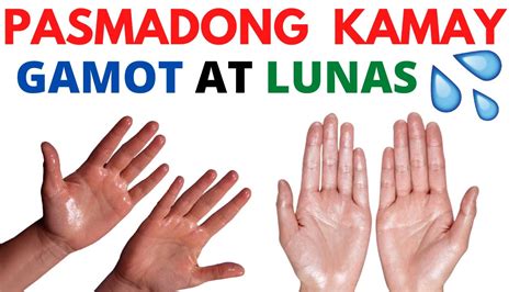 What To Do If Pasmado Ang Kamay Hubad Kamay