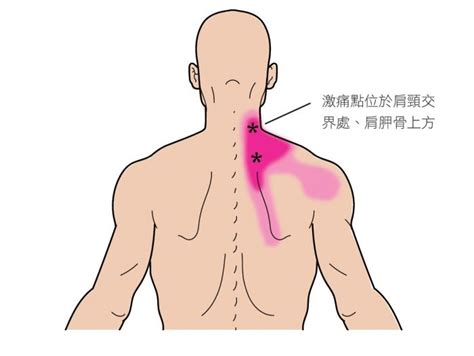 《全圖解關節穴道激痛點療法》對症按摩！緩解常見四部位肩頸疼痛 傷害預防 健康生活 運動視界 Sports Vision