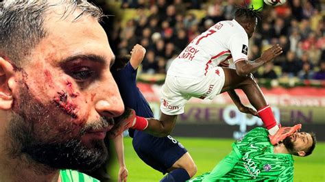 VIDEO Goalkeeper Gianluigi Donnarumma Left With Facial Injuries After