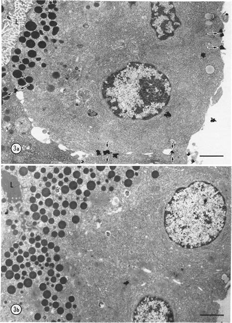 A An Electron Microscopic Autoradiograph Of A Rat Pancreatic Acinus