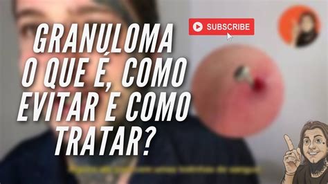 O Que O Granuloma Do Seu Piercing Como Ele Surge E Como Tratar