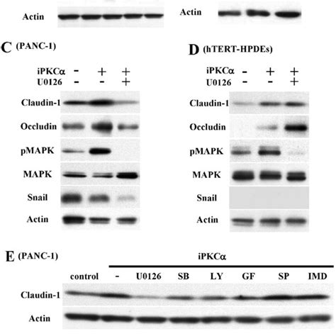 A Western Blotting For Snail Claudin 1 4 7 And Occludin In