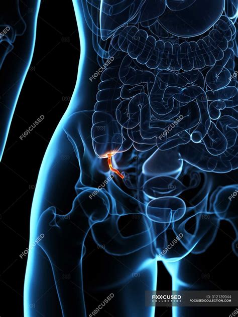 Inflamed appendix in human body, conceptual digital illustration