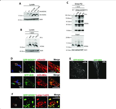 Noxa Gets Degraded At Lysosomes Western Blot Analysis Of Hela Cell Download Scientific Diagram