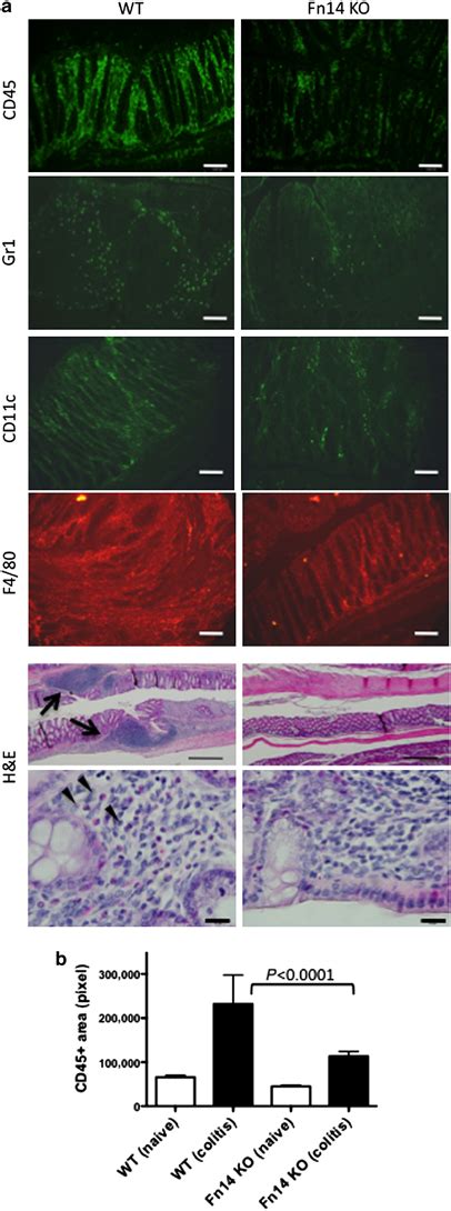 Infiltrating Cells In Chronic Trinitrobenzene Sulfonic Acid