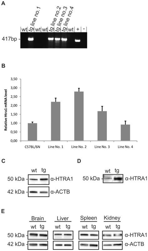 A Pcr Of Genomic Dna From Transgenic And Wt Mice Transgenic Mice Download Scientific Diagram