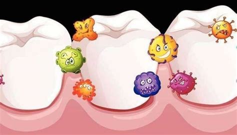 口腔细菌不仅让你掉牙 还会掉智商牙龈
