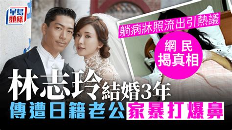 林志玲結婚3年傳遭日籍老公家暴打爆鼻 躺病牀照流出引熱議網民揭真相