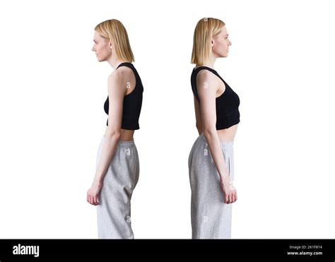 Comparison Of Bad And Good Posture Woman Slouching And Straightening