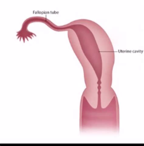 Unit 2 Uterine And Vaginal Pathologies Flashcards Quizlet