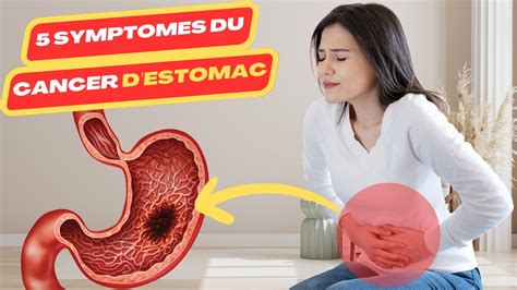 Symptomes Du Cancer Estomac Cancer D Estomac Sympt Mes Cancer De