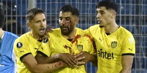 Copa Libertadores 2024 | Maxi Olivera, Peñarol player, receives stones from Rosario Central fans ...