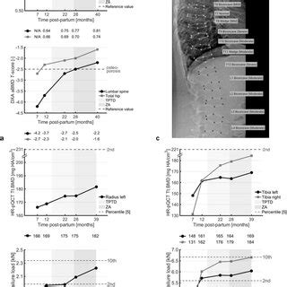 PDF Bone Microarchitecture And Strength Changes During Teriparatide