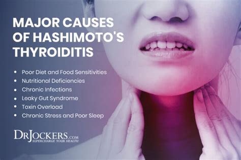 Hashimotos Thyroiditis Causes Symptoms And Support Strategies